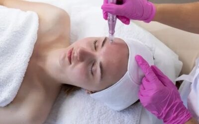 How Microneedling in Boynton Beach Can Improve Skin Texture and Tone