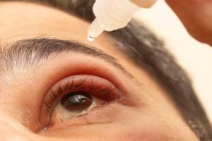 No-Touch Stye Care With a Simple Facial Spray