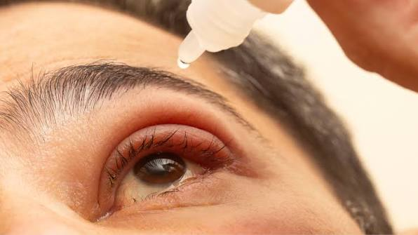 No-Touch Stye Care With a Simple Facial Spray